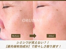 オルディーネ(ORUDiNE)