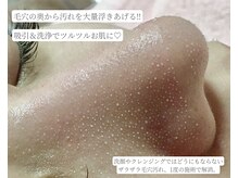 ルナベル(Luna Bell)の雰囲気（ハイドラ毛穴洗浄/くすみ/シミ/乾燥/ハリ/シワ/赤ら顔/肌管理）