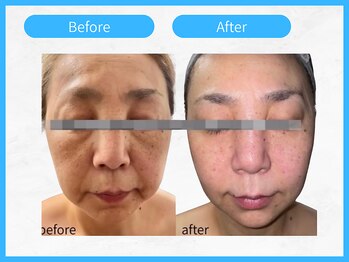 RHB東戸塚/小顔エステはRHB東戸塚