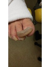 足楽 横浜白楽店/施術前