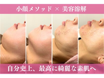 オッティモ(Ottimo)の写真
