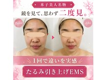 米子美人