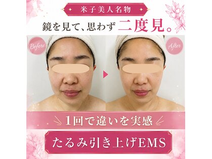 米子美人の写真
