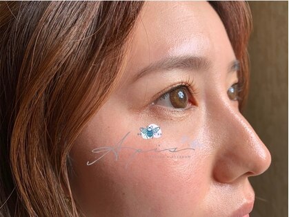 アピス(APIS)の写真