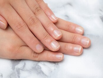 スターネイル(Starnail)の写真/【深爪、短い爪、むしり癖のお悩みの方へ◎】お爪の形や状態をしっかり見ながら丁寧な施術でモチ◎