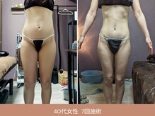 ラグーン(Lagoon)/WINBACK×筋膜リリース