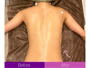 クレヴィア バイ サイバーエステ(CREBIA)/【背中集中】90分