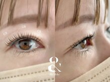 ムニ(muni)/&healthy【アンドヘルシー】