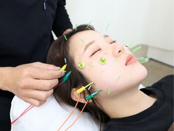 ゆず鍼灸整骨院の写真/【有名雑誌掲載☆当店人気No.1】小顔美容鍼＋矯正☆美肌も叶う速攻リフトアップ！初回半額