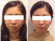 美容整体ウェリナ 中川八田院/小顔矯正/骨盤矯正/美脚サロン