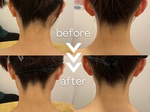 痩身&ブライダルエステサロン MillS 小倉店【3/2 NEW OPEN（予定）】/ブライダルシェービング