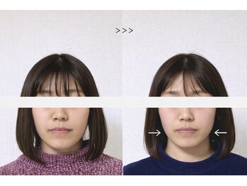 ミラ 長崎駅前店(MIRA)/小顔専門店 #造顔 #小顔矯正