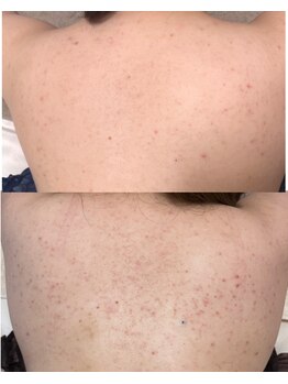 モンクラッシー(Mon classy)/