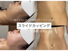 エクラ(eclat)の雰囲気（スライドカッピングで全身血流ケア★結果がすぐ出るからリピ続出）