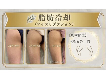 エステティックサロン フェアリー(ESTHETIC SALON FAIRLY)の写真