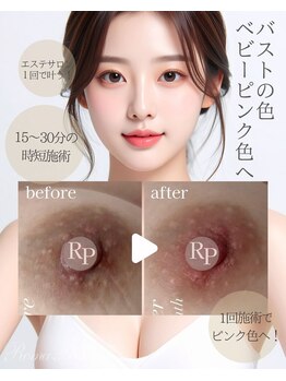 ティアラ(Tiara)の写真/嬉しい完全個室♪《ローマピンクモニター≫唇/乳輪/デリケートゾーンの黒ずみ悩みを肌本来のピンク色へ