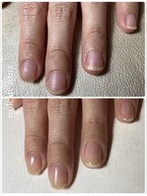 ネイルカフェ ナナ(nailcafe'nana)/自爪育成矯正