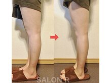 サロンアール(SALON R)/太もも、ふくらはぎスリム♪