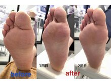 シェル トウキョウ(SHELL TOKYO)/