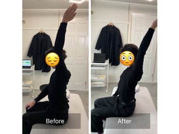 ナオル整体 恵比寿院(NAORU整体)/恵比寿/整体事例【猫背矯正】