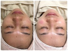 マヴィ 高槻店(MavY.)/素肌トーンアップ