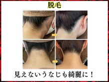 ニコ 岐南本店(Nico)/脱毛★うなじ