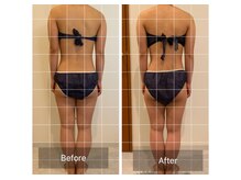 ラシェリー(La Cherie)/ビフォーアフター