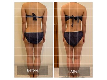 ラシェリー(La Cherie)/ビフォーアフター