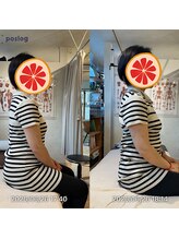 グレフル鍼灸接骨院 整体院 心斎橋/整体/肩こり/マッサージ/腰痛