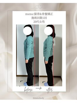 ヒナノボディ(HINANO BODY)/お客様ビフォーアフター