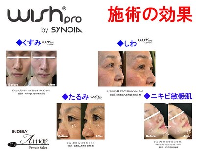 アモル(Amor)の写真