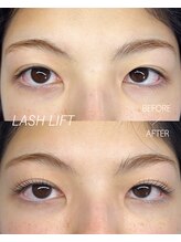 ウィロー(WILLOW)/LASHLIFT
