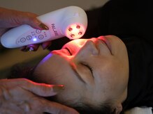 フェルトゥーナ(FORTUNA)/お肌の悩み、全て解決小顔効果◎