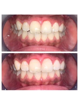 ライトビューティー 池袋店(LightBeauty)/症例写真