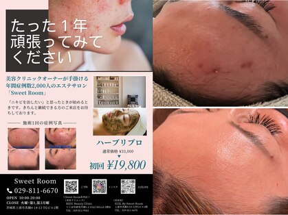スイートルーム(Sweet Room)の写真