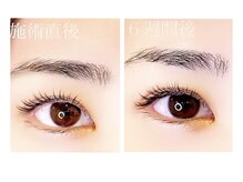 シュシュ(Chouchou)/