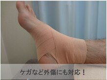 あさひろ鍼灸整骨院 西葛西院/ケガなど外傷にも対応！