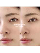 アムラット(amlat)/まつ毛パーマ