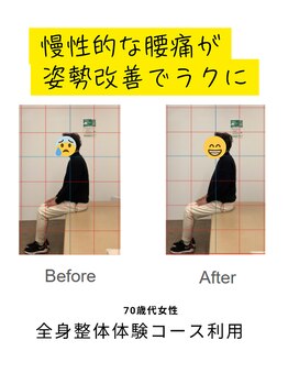いつでもリハビリ 甘木整体院/慢性的な腰痛の原因は姿勢かも?