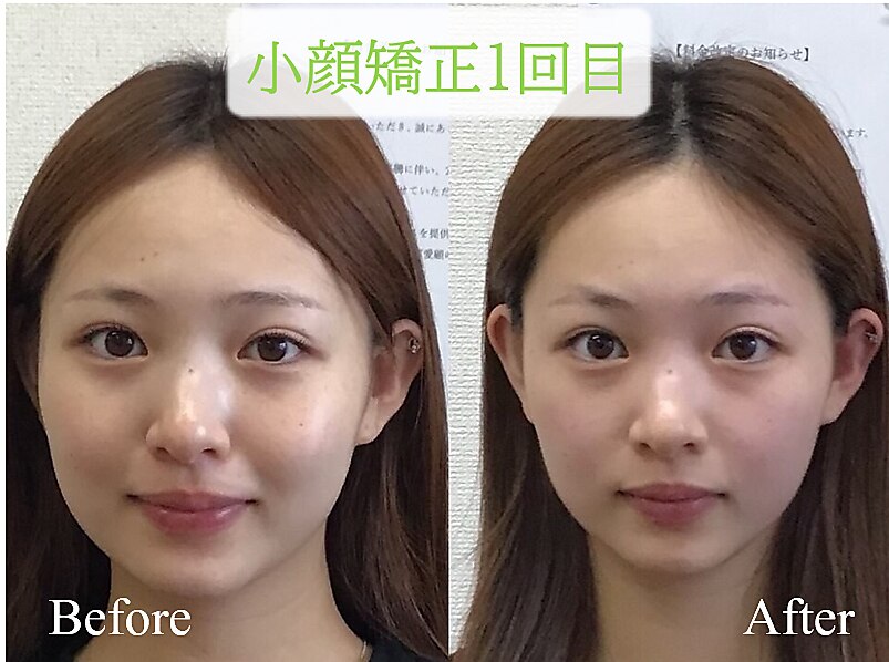 フォト｜オズ六本木｜ホットペッパービューティー