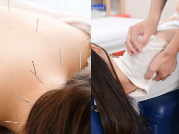 ゆず鍼灸整骨院の写真/首肩コリの専門メニューが充実！肩こり・頭痛・眼精疲労・猫背まで鍼灸整体で徹底改善！初回半額