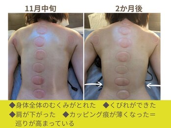 水玉屋(suidamaya)/「くびれ」がくっきり出現