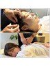 【深い呼吸で柔らかな表情を】美容鍼＋上半身の不調整体80分 ¥13200→¥11,000