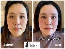 ヘイレン 表参道(Heilen)