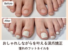 ネイルサロン プロムナード(nailsalon promnade)/120分後には自信のある足元に