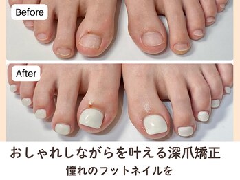 ネイルサロン プロムナード(nailsalon promnade)/120分後には自信のある足元に