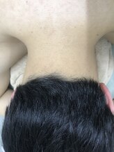 ナノハナ/鹿沼市の全身脱毛のナノハナ