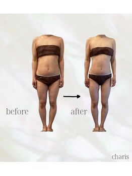 カリス(charis)/ビフォー&アフター