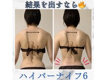 ビナル(BeNAL)/痩身☆ハイパーナイフB/A