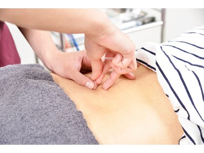 ゼロスポ鍼灸 整骨院 大口通の写真